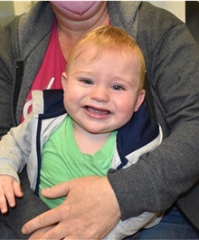 Craniosynostosis After Photo by Rachel Ruotolo, MD; Garden City, NY - Case 42478