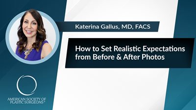 How to Set Realistic Expectations From Before & After Photos